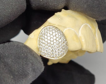 Custom 10K Yellow Gold Moissanite Diamond Grillz - Honeycomb VVS Setting