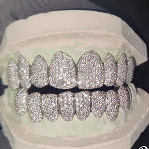 Iced Moissanite Diamond Custom Teeth Grillz | Custom Moissanite Diamond 10 on 10 Teeth Grillz in Silver, 10K , 14K Yellow, Rose, White gold