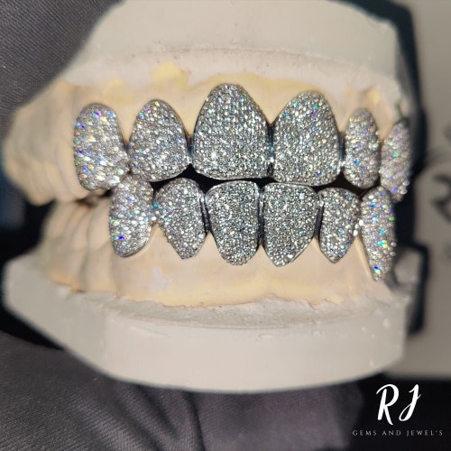 VVS Moissanite Diamond Grillz: Custom Sterling Silver, Gold, 10 Top and Bottom grilz set