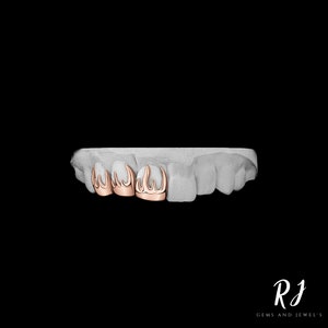 May include: Close-up of a set of four gold-colored dental grills with a flame design. The grills are set on a white model of a mouth.