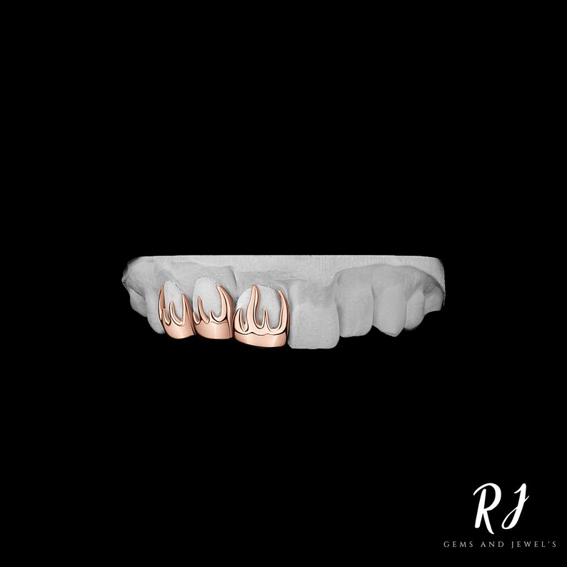 May include: Close-up of a set of four gold-colored dental grills with a flame design. The grills are set on a white model of a mouth.