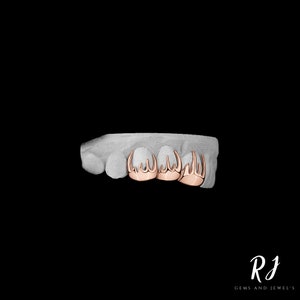 May include: A close-up of a set of gold teeth with a pointed design. The teeth are set on a white model.