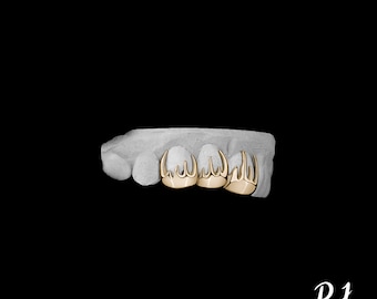 Custom 10K Gold Flame Grillz - Hot Girl Style