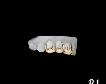 Custom 10K Solid Gold Hot Flame Teeth Grillz For Her by RJ Gems and Jewels