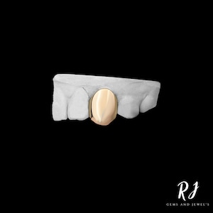 May include: A gold tooth cap, also known as a grill, is shown on a model of a mouth. The tooth cap is a single, front tooth.