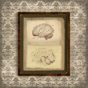 Printable Vintage Human Anatomy Wall Art, Brain Cross-Section, Reproduction Vintage Anatomical Illustration, Antique Medical Anatomy Print
