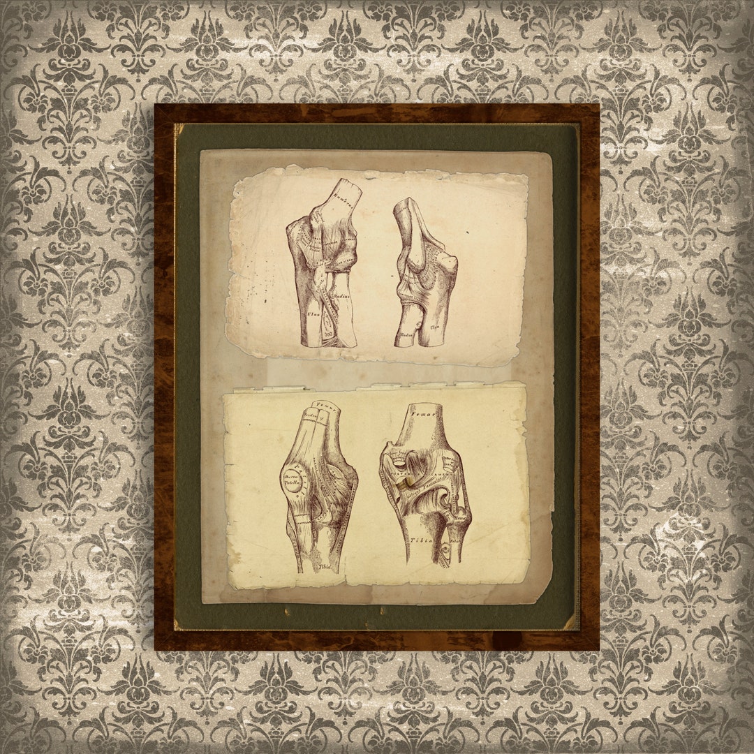 Printable Vintage Human Anatomy Wall Art, Arm and Leg Bones ...