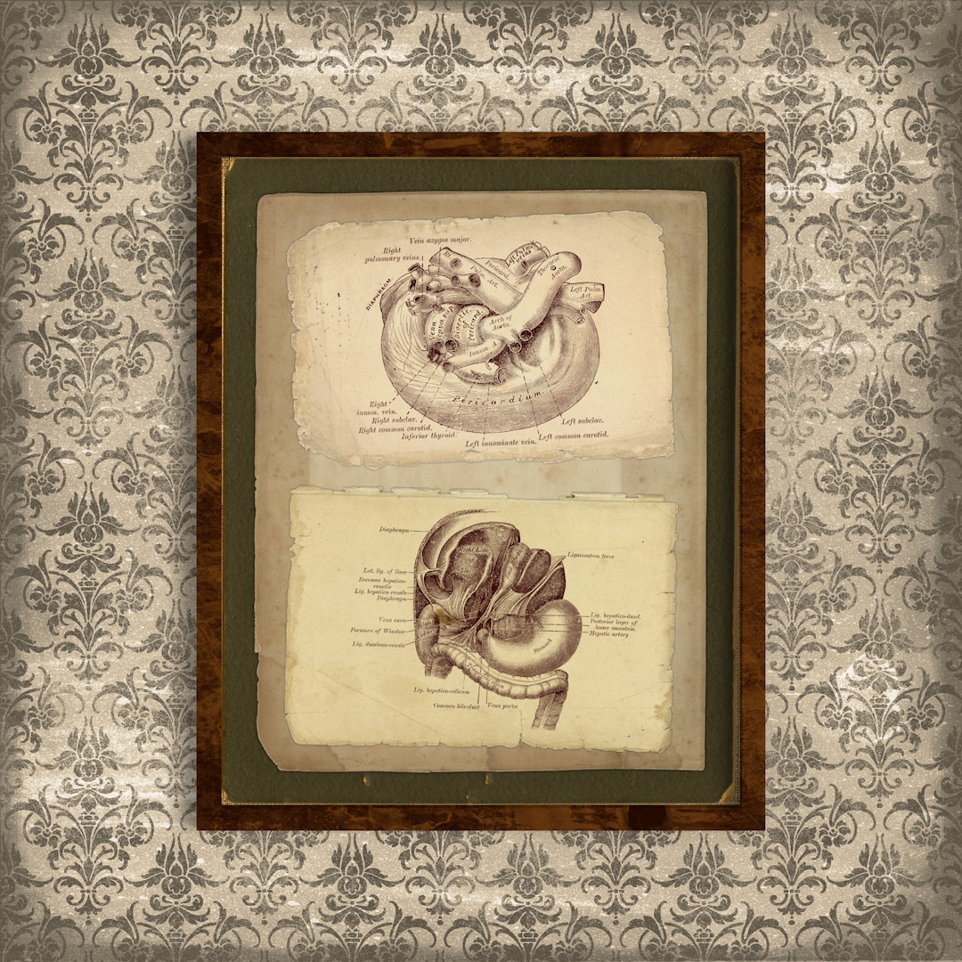 Printable Vintage Human Anatomy Wall Art, Digestive System, Antique ...