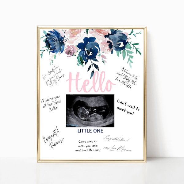 Baby sonogram photo sign in navy and blush. Baby ultrasound printable for gender reveal party. Learn more in description below.