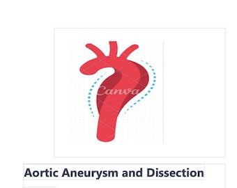 Aortic Aneurysm and Dissection-ETSY