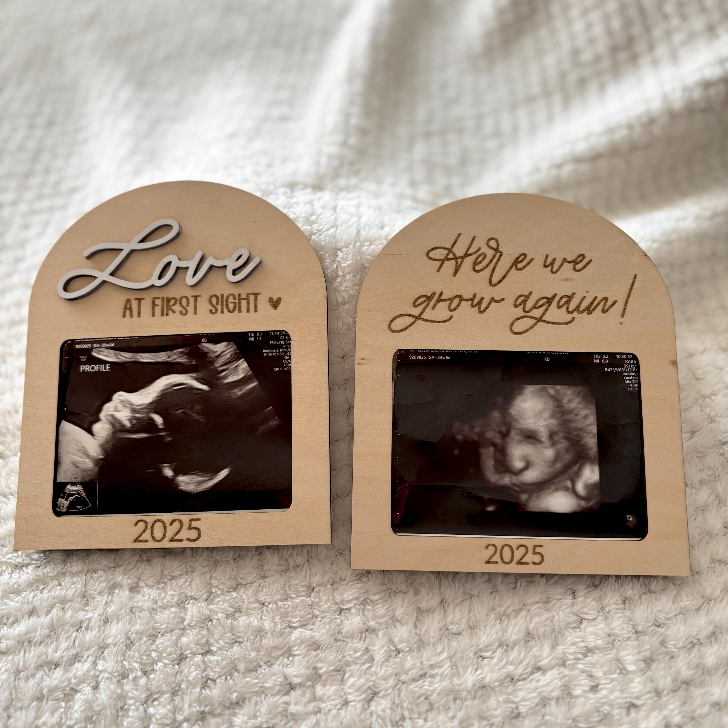 Sonogram Magnets Ultrasound Fridge Magnet, Pregnancy Fridge Magnet, Coming Soon ...