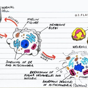 Inflammation Flashcards (PDF)