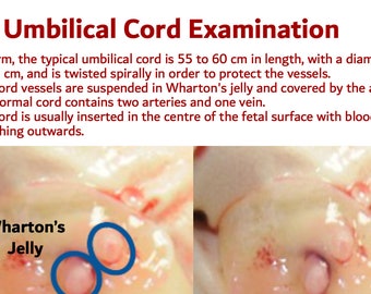 Intrapartum Clinical Notes Bundle