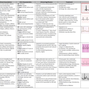 Cardiac Dysrhythmia Chart Med-Surg