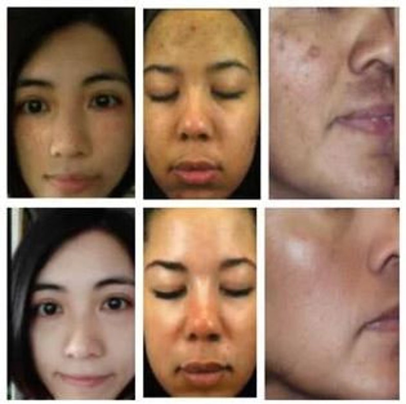 Dark Skin Bleach Body Bleaching Cream Max Strength Whitening Etsy