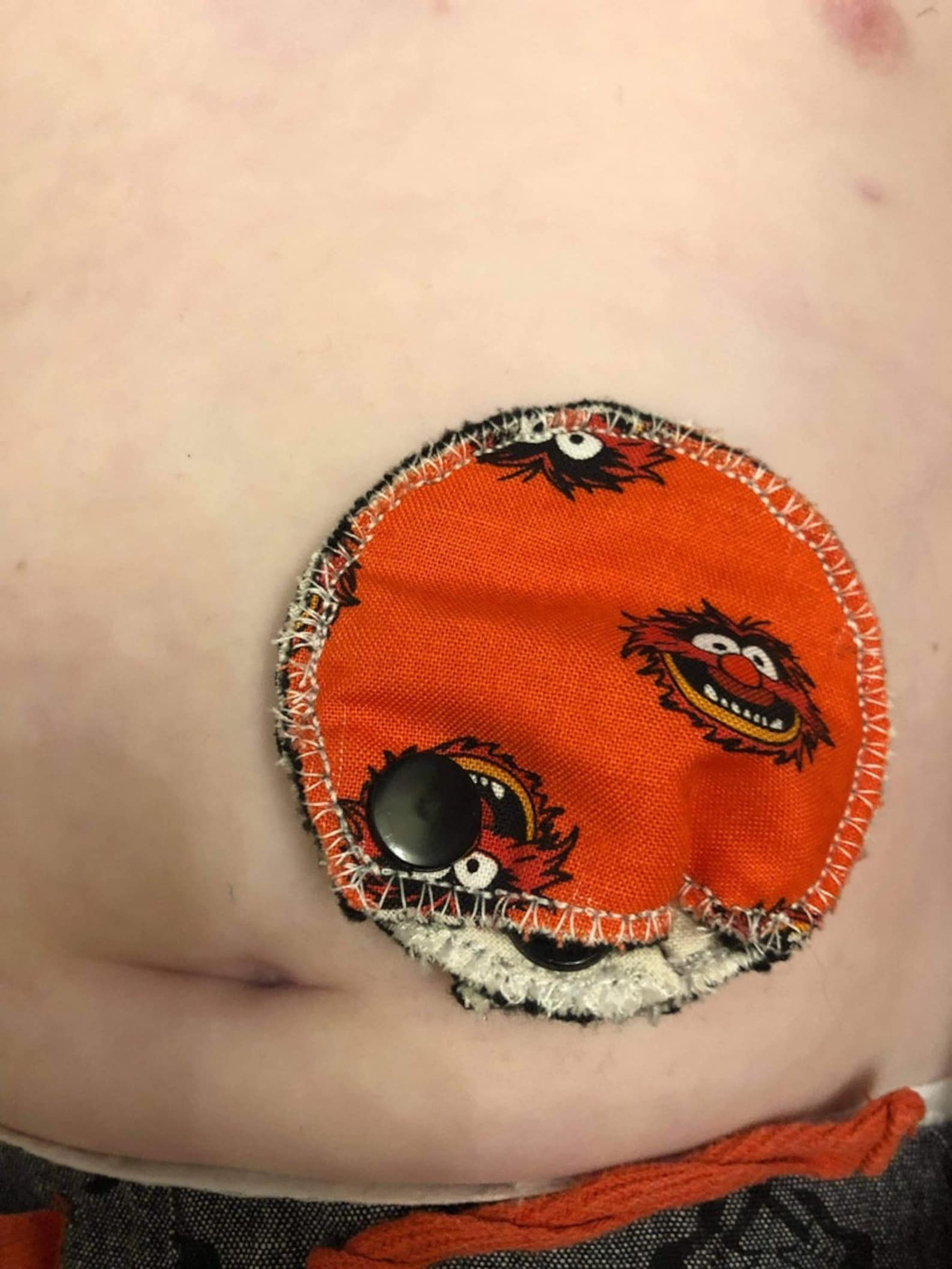 Gtube Cover Transportation Tubie Covers Tubie Pads Feeding Etsy