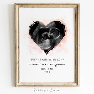 1st Time Mothers Day Ultrasound Print Gift for Expecting Mom, Baby Sonogram Print Pregnant Mom Gift, Gift for Mommy to Be • Digital Download