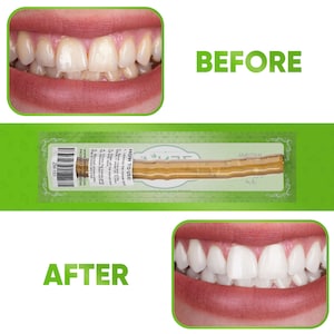 May include: Before and after photos of a person's teeth. The before photo shows yellow teeth. The after photo shows white teeth. A packaged Miswak stick is shown in the middle of the image. The package is green and has the text "HOW TO USE" and "JARLITA" on it. The text "ZM-153" and "PRODUCT OF PAKISTAN" are also visible on the package.