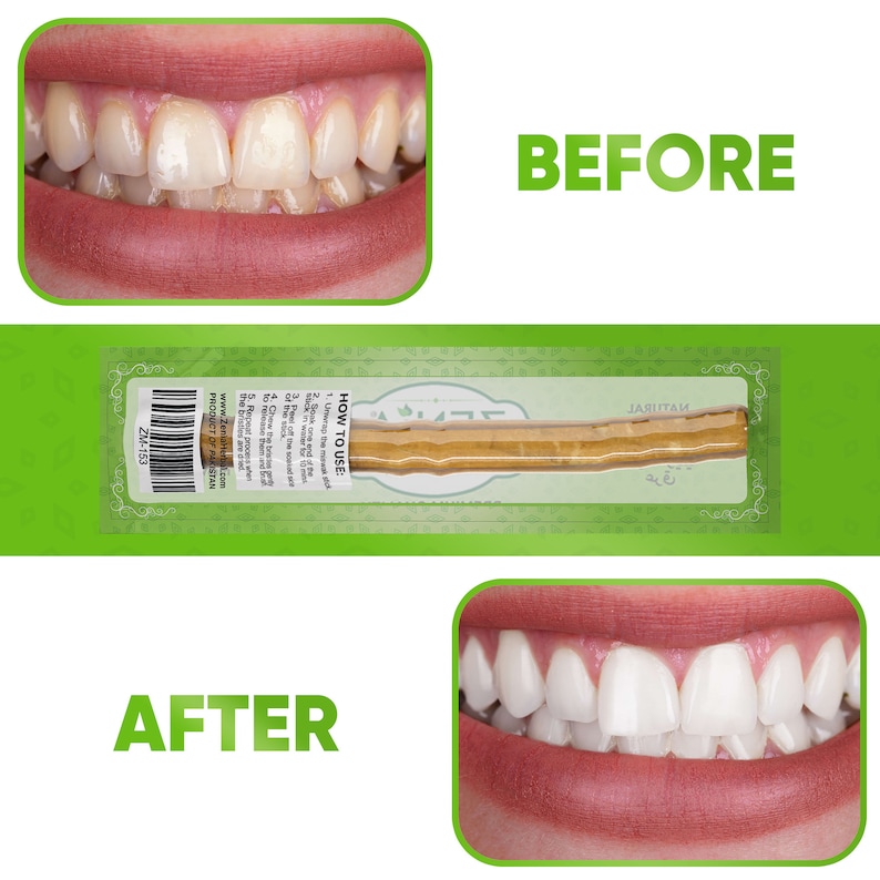 May include: Before and after photos of a person's teeth. The before photo shows yellow teeth. The after photo shows white teeth. A packaged Miswak stick is shown in the middle of the image. The package is green and has the text "HOW TO USE" and "JARLITA" on it. The text "ZM-153" and "PRODUCT OF PAKISTAN" are also visible on the package.