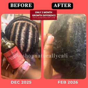 K&ouml;nnte beinhalten: Vorher-Nachher-Vergleich des Haarwachstums mit Naturally Cali Haar&ouml;l. Das linke Bild zeigt eine geflochtene Kopfhaut im Dezember 2025, das rechte Bild das Haarwachstum im Februar 2026. Die Produktflasche ist sichtbar.