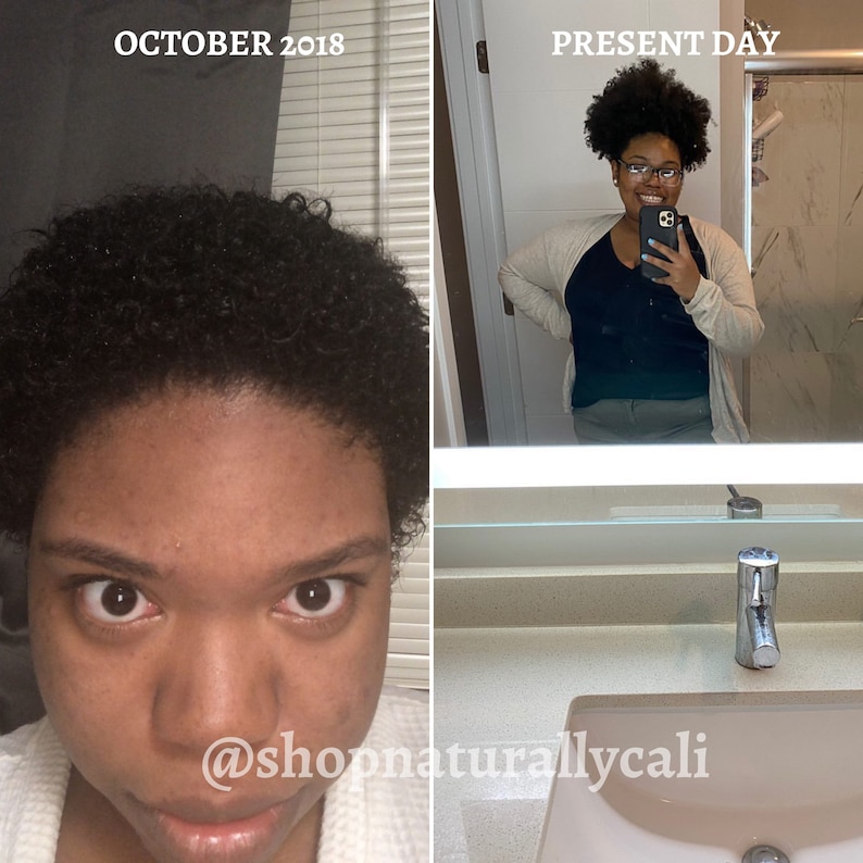 Hair Growth Oil Ayurvedic Natural Hair Alopecia Treatment Etsy