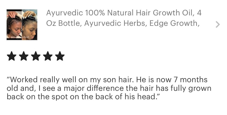 Ayurvedisches Haarwuchsöl: Amla & Rosmarin, natürliche Alopeziebehandlung Bild 13