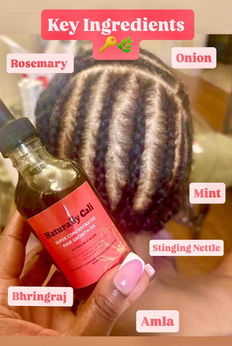 K&ouml;nnte beinhalten: Eine Flasche "Naturally Cali" hochkonzentriertes Haarwuchs&ouml;l mit einer Pipette. Das Etikett listet die wichtigsten Inhaltsstoffe auf: Rosmarin, Zwiebel, Minze, Brennnessel, Bhringraj und Amla. Der Hintergrund zeigt geflochtenes Haar.