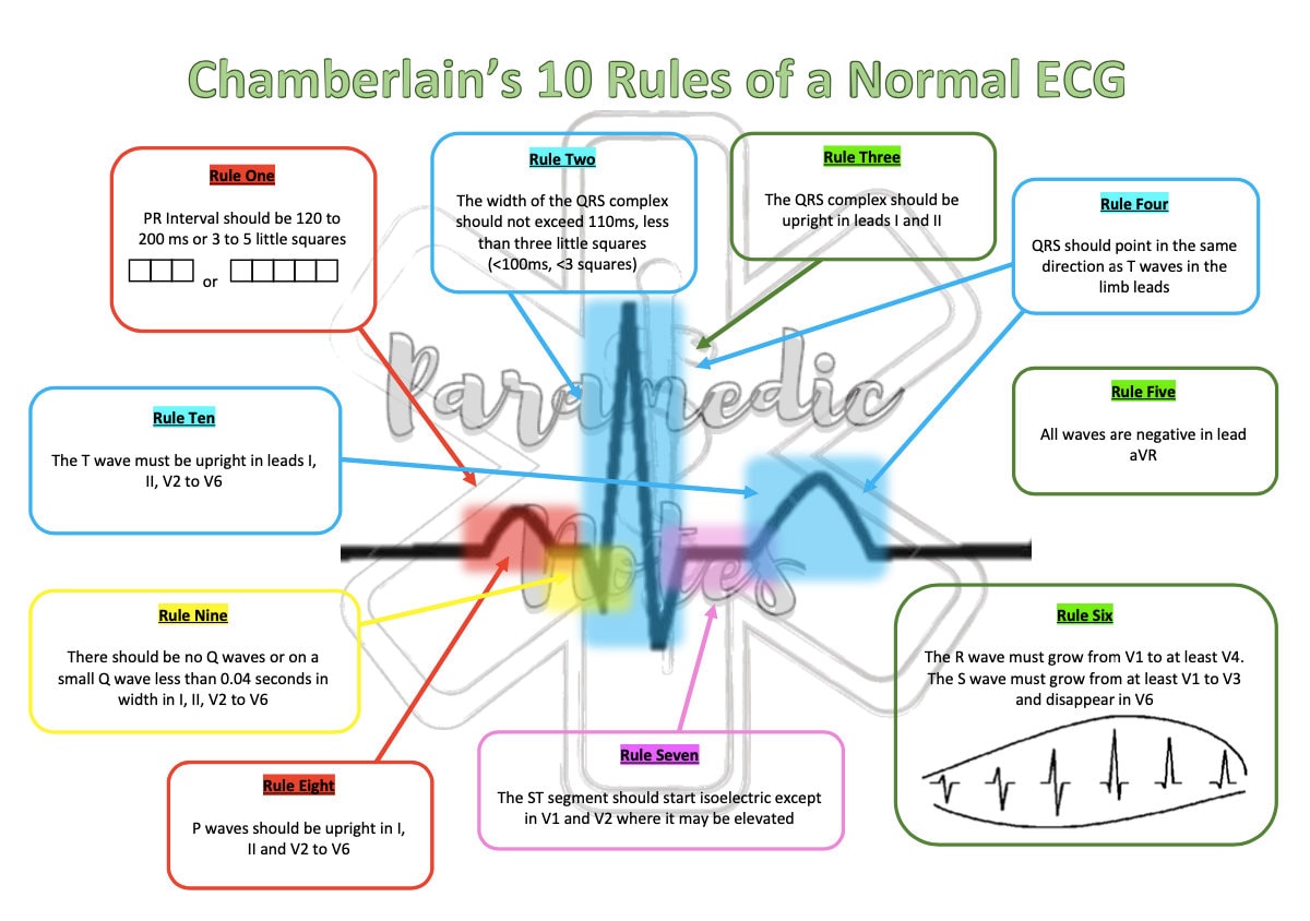 Chamberlain's 10 Rules of a Normal ECG Etsy