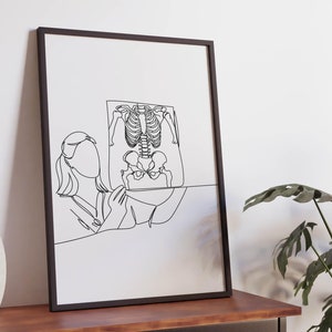 Arte lineal de radiografía minimalista, descarga digital, impresión de rayos X, póster de hospital, imprimible de atención médica, regalo para doctores radiólogos.