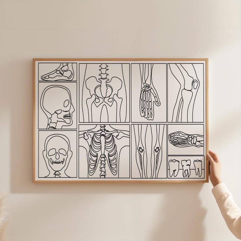 Picture Frame Pattern Radiography Minimalist Radiography Set of 6 Wall Gallery Line Art, Digital Download ...