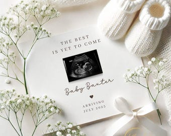 May include: White card with a black and white ultrasound image and the text "The best is yet to come. Baby Baxter arriving July 2025."  The card is surrounded by white baby booties and white flowers.