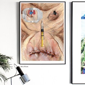 May include: A close-up of a watercolor painting depicting a human face with stitches, a fly, and a syringe. The syringe is labeled "NEO-MORFIN". The painting is framed in black and measures 50 x 70 cm.