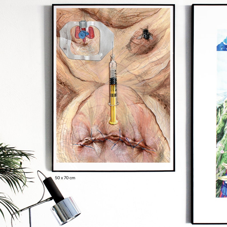 May include: A close-up of a watercolor painting depicting a human face with stitches, a fly, and a syringe. The syringe is labeled "NEO-MORFIN". The painting is framed in black and measures 50 x 70 cm.