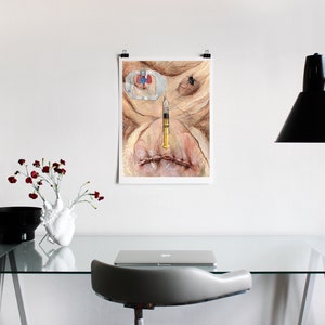 May include: A framed print of a watercolor painting depicting a close-up of a human face with a syringe inserted into the nose. The face is pale with a red and blue medical device attached to the forehead. The background is a light beige.