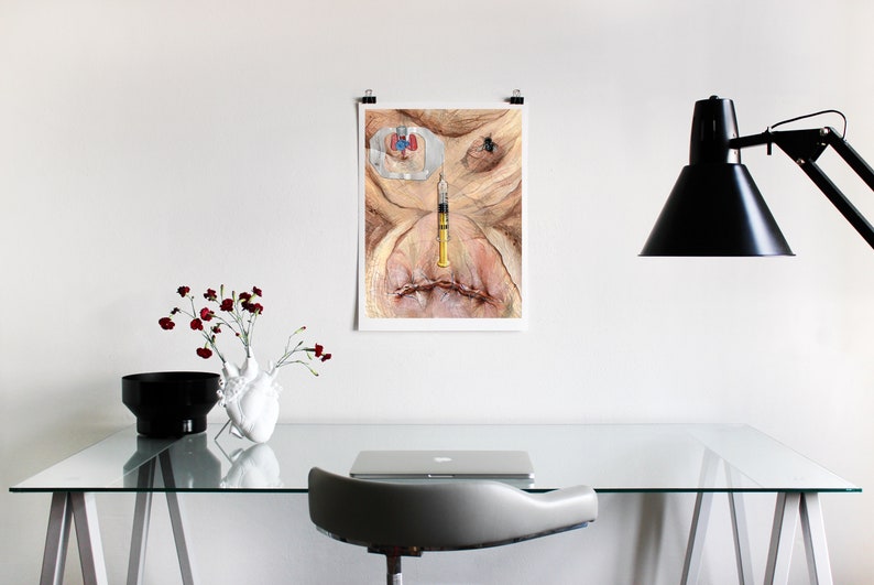 May include: A framed print of a watercolor painting depicting a close-up of a human face with a syringe inserted into the nose. The face is pale with a red and blue medical device attached to the forehead. The background is a light beige.