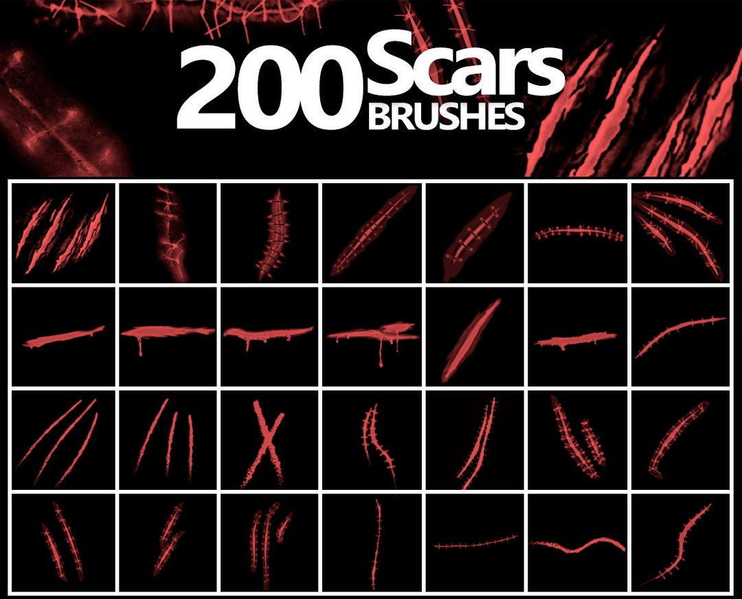 Scars Brushes, ABR Wounds, Brushes Bruise, Lacerated Wounds
