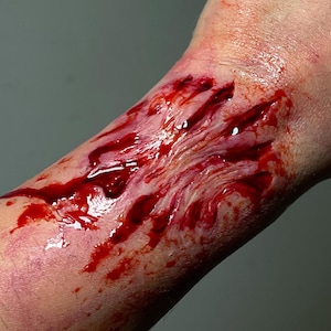 Puede incluir: Primer plano de una herida sangrante en la muñeca de una persona. La herida es profunda y dentada, y hay mucha sangre.