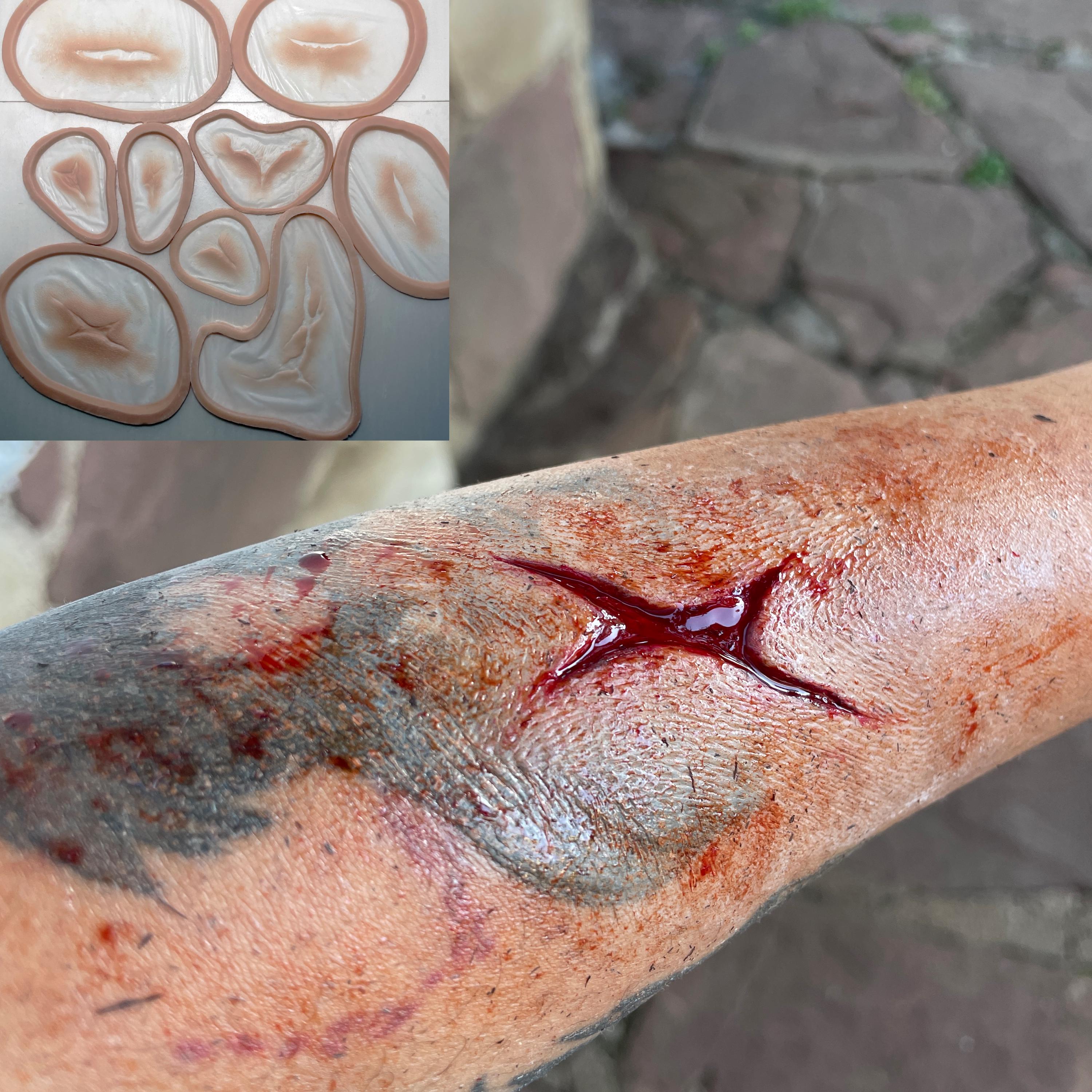 Siliconen wondkit – Klinisch | HealthySimulation.com, image size:3000x3000