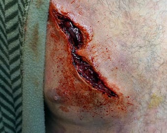 May include: A close-up of a bloody wound on a person's chest. The wound is deep and appears to be a laceration. There is blood splattered around the wound.