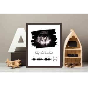 Der erste Herzschlag des benutzerdefinierten Babys PRINTABLE-Schwangerschaftsankündigung-scannbarer QR-Code mit Ihrem Babys Herzschlag Audio-Ultraschall Foto & Herzschlag