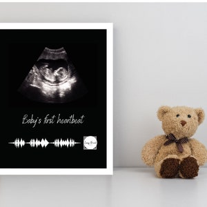 Baby's First Heartbeat-Scannable QR Code with Your Heartbeat recording-Pregnancy Announcement-Custom Printable-Ultrasound photo & heartbeat