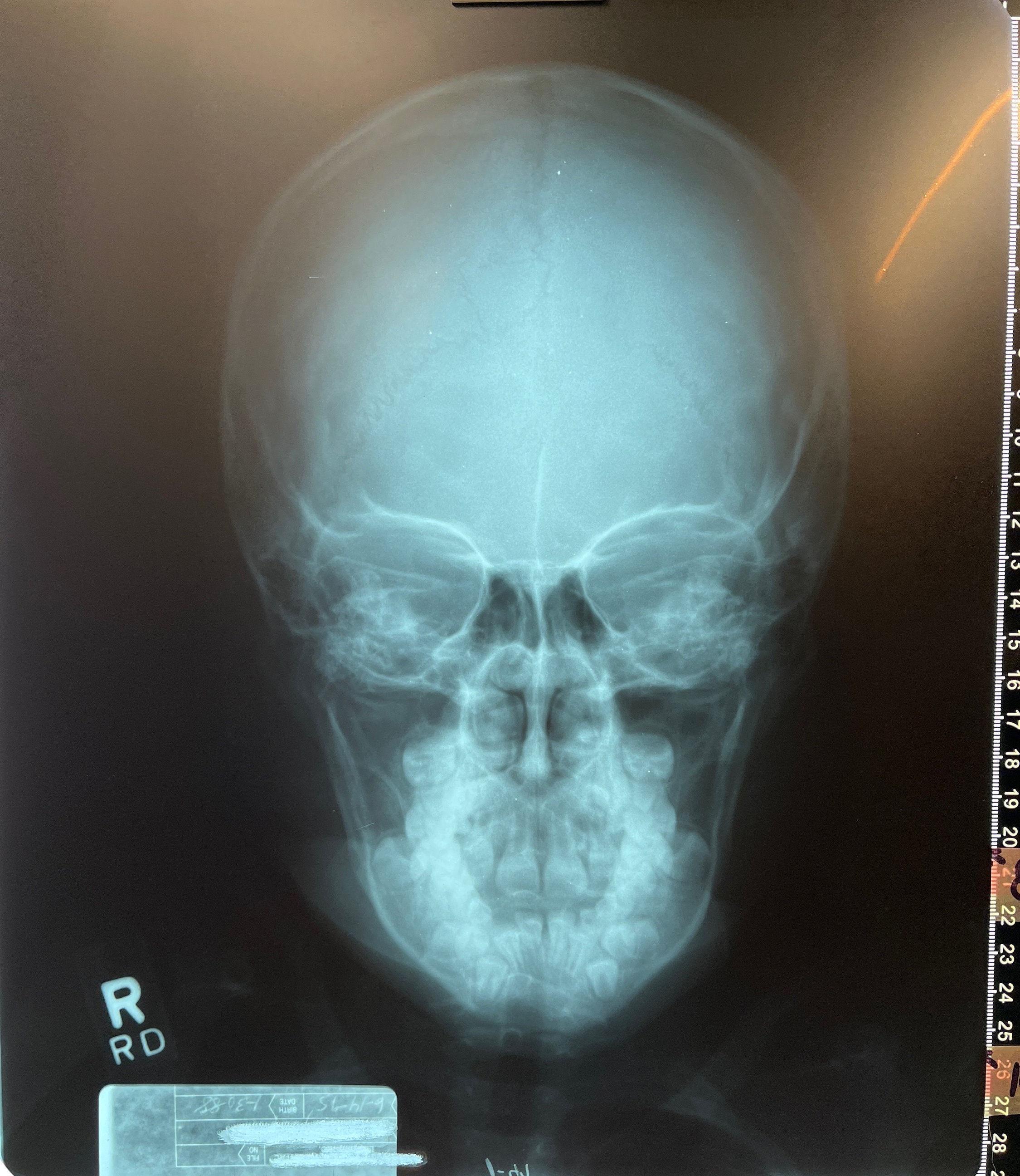 BONES Portrait X-ray Marker Parker for Radiology Technologist
