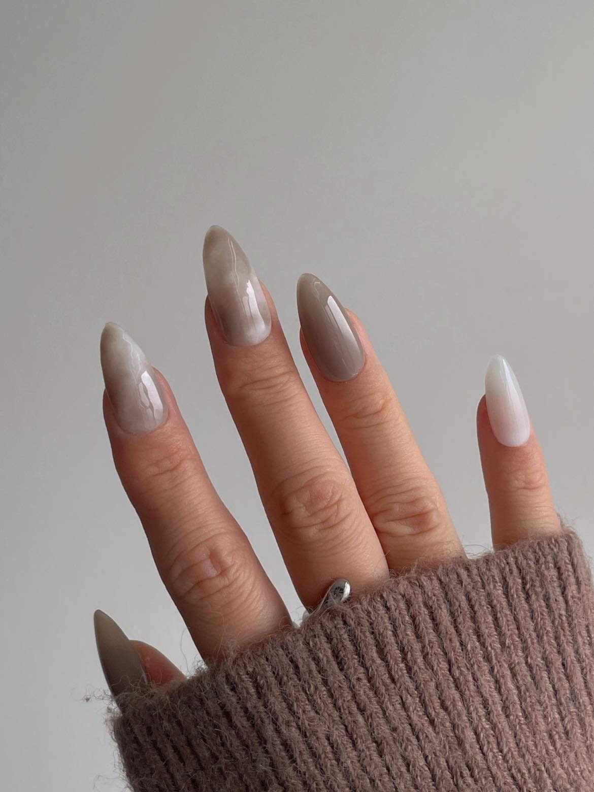 Clubbed thumb acrylics | Almond nails, Nails, Acrylic nails
