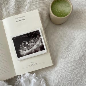 Premium linen pregnancy journal keepsake in soft beige with embossed gold title on a white background GROWING YOU. Ultrasound pages inside pregnancy journal.