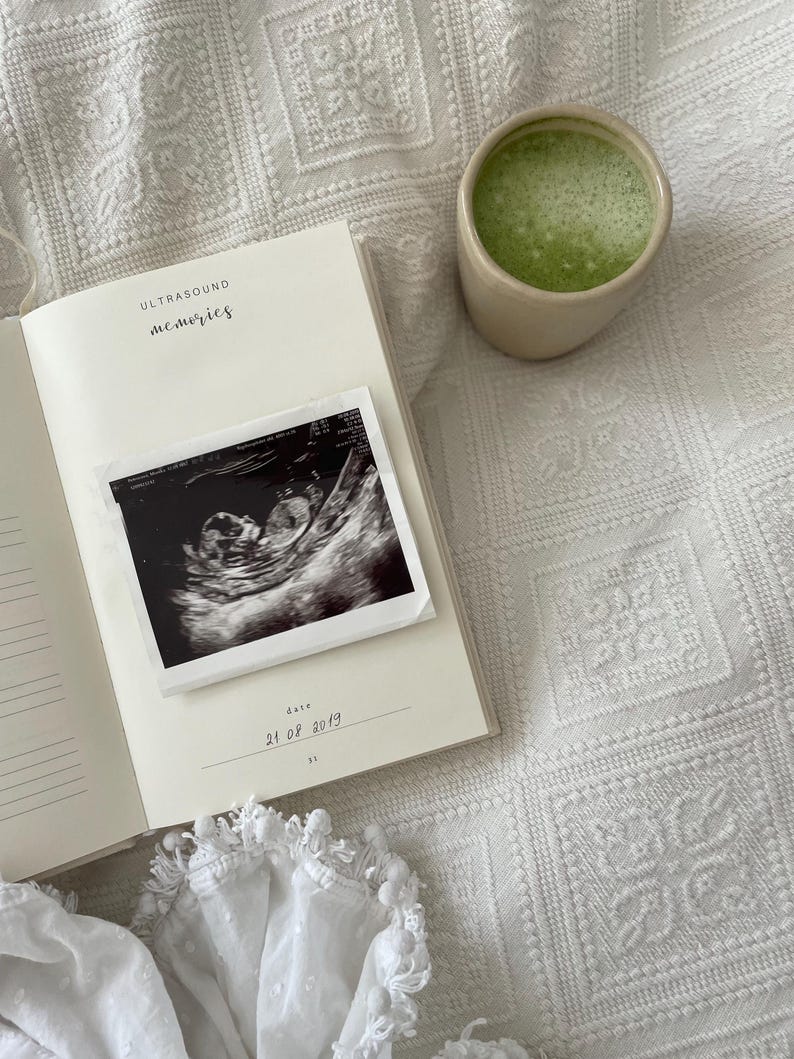 Premium linen pregnancy journal keepsake in soft beige with embossed gold title on a white background GROWING YOU. Ultrasound pages inside pregnancy journal.