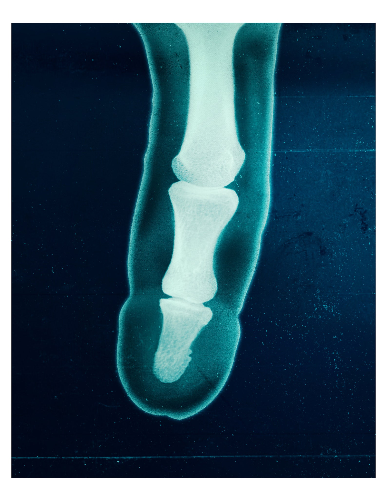 Boner XRay wall art print home decor wall art print Etsy