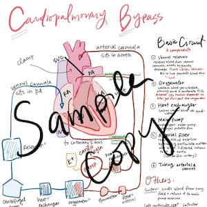 May include: A hand-drawn diagram illustrating the process of cardiopulmonary bypass surgery. The diagram shows the heart, lungs, and major blood vessels, as well as the equipment used during the procedure. The text includes the terms "Basic Circuit", "Venous Reservoir", "Oxygenator", "Heat Exchanger", "Main Pump", "Arterial Filter", "Tubing", "Potassium Cardioplegin", and "Others".
