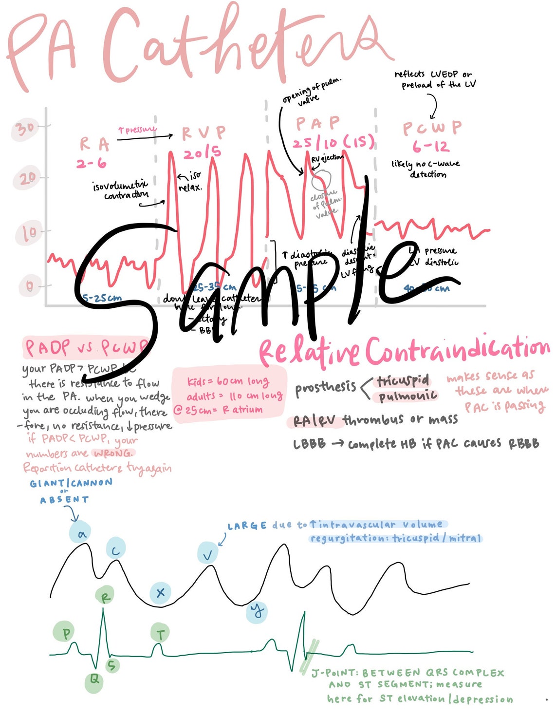 Cardiac Anatomy Monitoring Anesthesia Notes Etsy