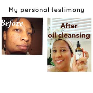 Oil cleanser, clears acne, get rid of acne, deep pore cleansing, pore reduction,  cleansing oil, made with essential oils, all natural