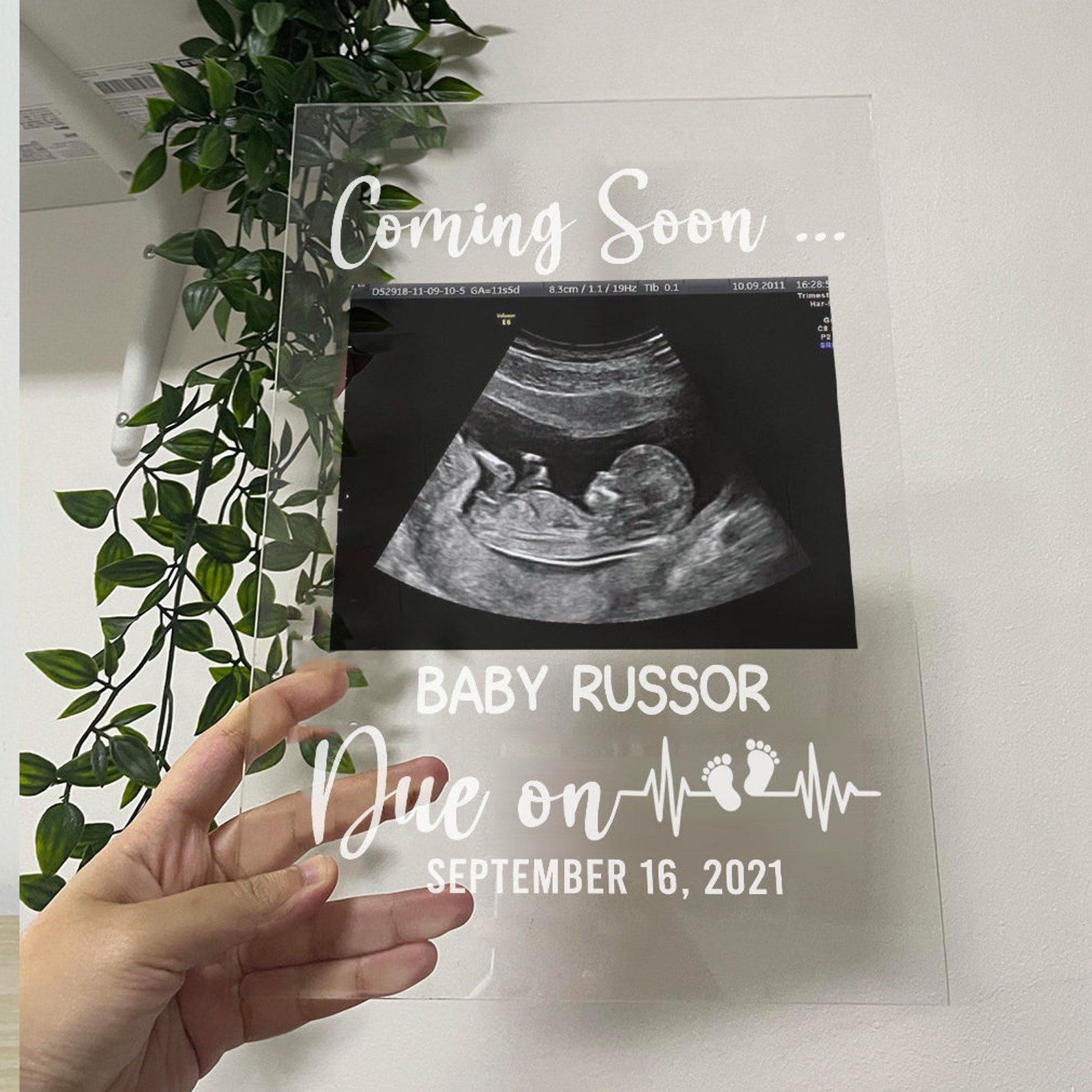 Ultrasound custom baby announcement pregnancy personalised Etsy